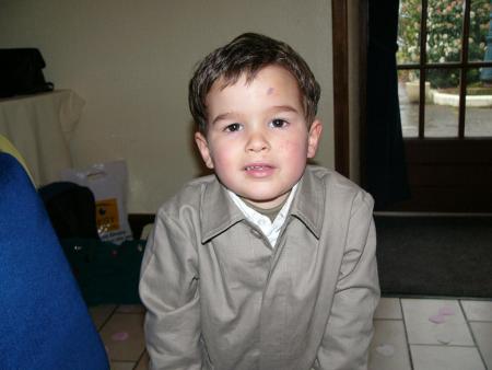 blessures cyclistes !!